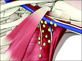 sample image using reduced complexity presented to surgeon participants