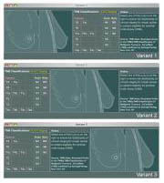 3 interface layout options presented to surgeon participants