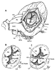 Open heart surgical anatomy