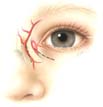 Pediatric Oculoplastic Surgery